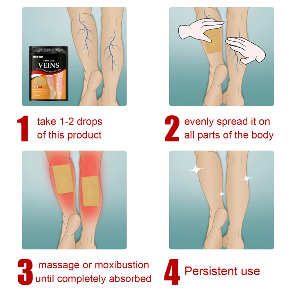 Parche para tratamiento de venas varicosas, yeso para hinchazón dolor de piernas, promueve el metabolismo, promueve la circulación sanguínea suave, Unisex, 12/24 unidades