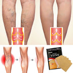 Parche para tratamiento de venas varicosas, yeso para hinchazón dolor de piernas, promueve el metabolismo, promueve la circulación sanguínea suave, Unisex, 12/24 unidades