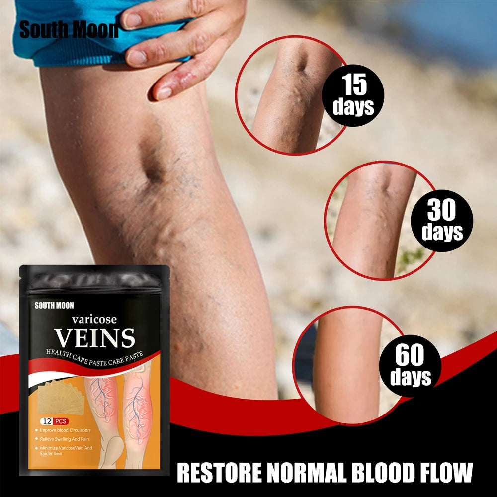 Parche para tratamiento de venas varicosas, yeso para hinchazón dolor de piernas, promueve el metabolismo, promueve la circulación sanguínea suave, Unisex, 12/24 unidades
