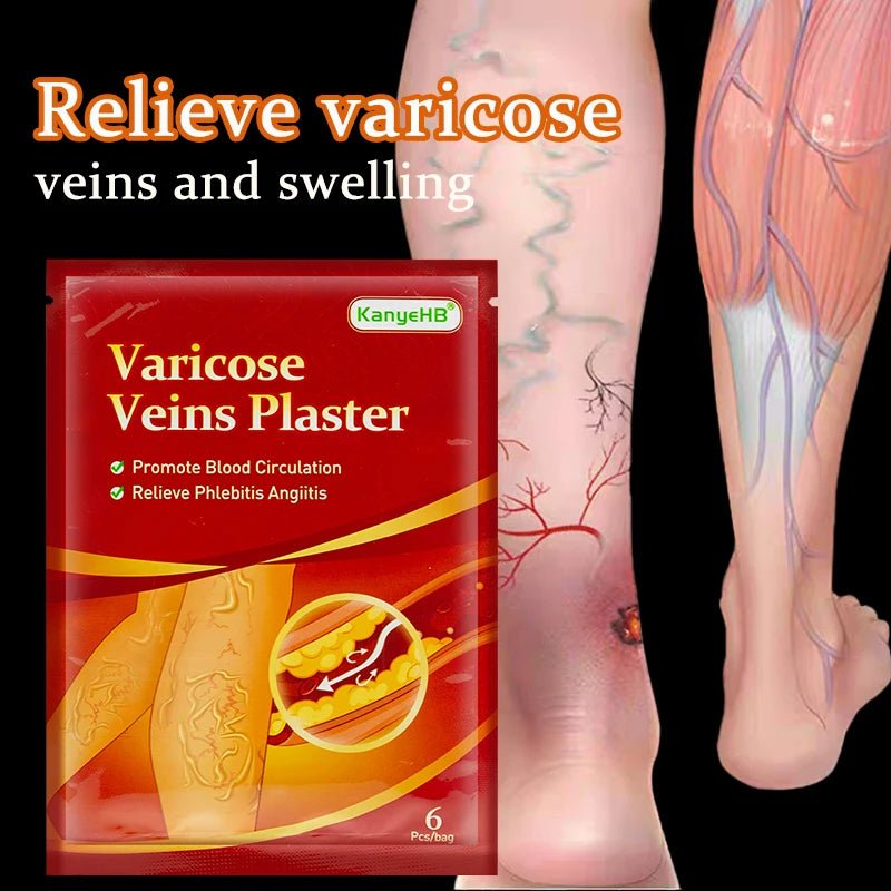 Parche de venas varicosas, eliminación de Vasculitis, flebitis, venas de araña, pierna, medicina Herbal china, yeso para el dolor de venas, 6, 12, 24, 36, 48, 60 piezas