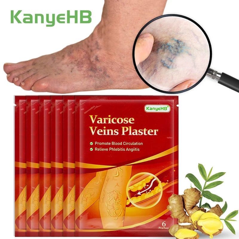 Parche de venas varicosas, eliminación de Vasculitis, flebitis, venas de araña, pierna, medicina Herbal china, yeso para el dolor de venas, 6, 12, 24, 36, 48, 60 piezas