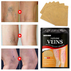 Parche para tratamiento de venas varicosas, yeso para hinchazón dolor de piernas, promueve el metabolismo, promueve la circulación sanguínea suave, Unisex, 12/24 unidades